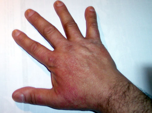 Mano