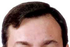 Pelo 1