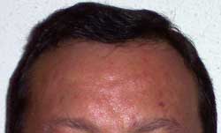 Pelo 10