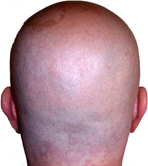 Pelo 16