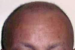 Pelo 18