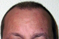 Pelo 19