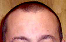 Pelo 2