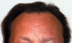 Pelo20