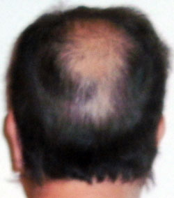 Pelo21