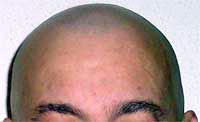 Pelo 3