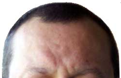 Pelo creciendo