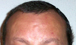 Pelo 7