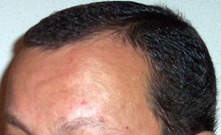Pelo 8