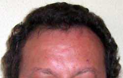Pelo rizado