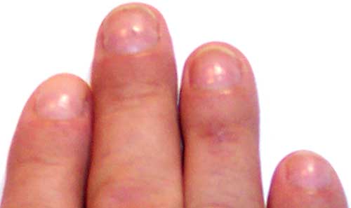 Ugnas 3